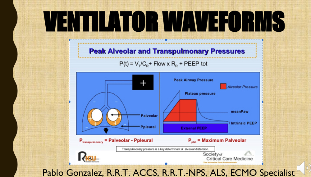 Ventilator Waveforms Event - Scripps Memorial